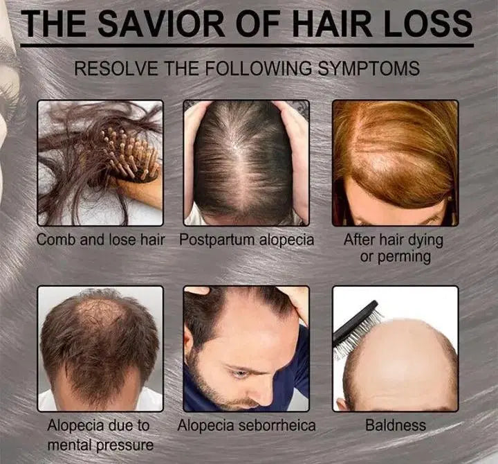Anti-Hair Loss Hair Serum