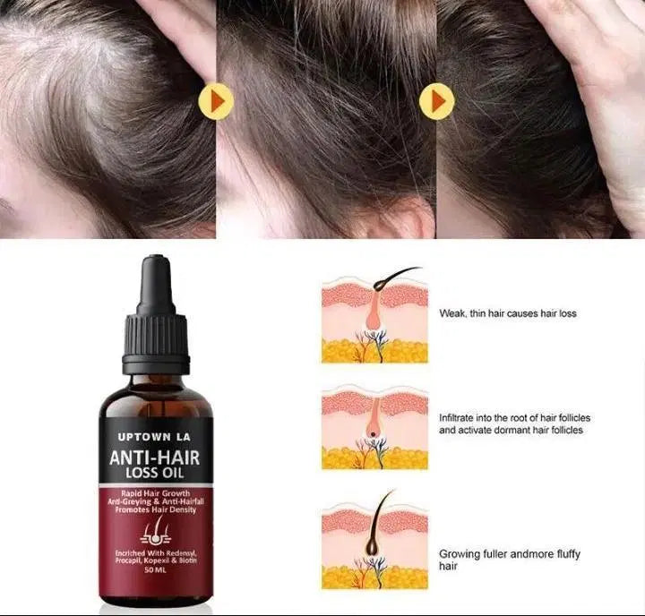 Anti-Hair Loss Hair Serum