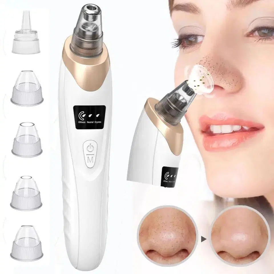 Battery Operated Black Head Remover